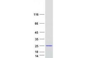 Validation with Western Blot (FLYWCH2 Protein (Transcript Variant 2) (Myc-DYKDDDDK Tag))