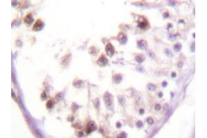 Immunohistochemistry analyzes of HDAC6 antibody in paraffin-embedded human testis tissue. (HDAC6 antibody)