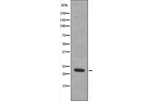 MRPS17 antibody  (Internal Region)