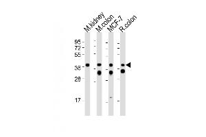 All lanes : Anti-Epcam Antibody (C-term) at 1:2000 dilution Lane 1: mouse kidney lysates Lane 2: mouse colon lysates Lane 3: MCF-7 whole cell lysates Lane 4: rat colon lysates Lysates/proteins at 20 μg per lane. (EpCAM antibody  (C-Term))