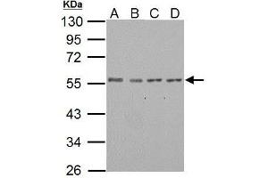 WB Image IP6K1 antibody detects IP6K1 protein by western blot analysis. (IP6K1 antibody)