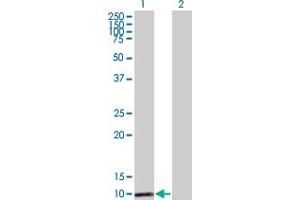 Western Blot analysis of MAPKSP1 expression in transfected 293T cell line by MAPKSP1 monoclonal antibody (M03), clone 2A4. (MAPKSP1 antibody  (AA 1-87))