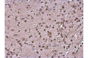 IHC-P Image NFIB antibody [N1C2] detects NFIB protein at nucleus on mouse fore brain by immunohistochemical analysis.