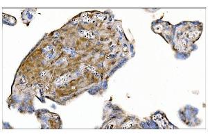 IHC analysis of MERTK using anti-MERTK antibody (ABIN7600623).