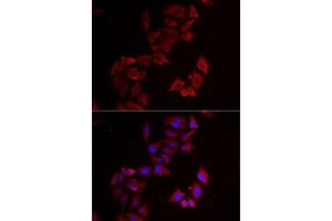 Immunofluorescence analysis of MCF7 cells using LIMS1 antibody (ABIN6132049, ABIN6143233, ABIN6143235 and ABIN6222007). (LIMS1 antibody  (AA 1-325))