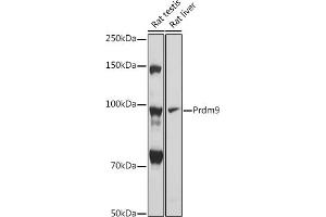 Western blot analysis of extracts of various cell lines, using Prdm9 antibody (ABIN7269502) at 1:1000 dilution. (PRDM9 antibody)