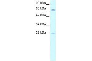 WB Suggested Anti-SUPT3H Antibody Titration: 0. (SUPT3H/SPT3 antibody  (N-Term))