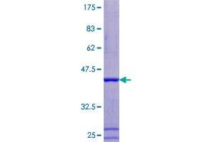 ATP6V1F Protein (AA 1-119) (GST tag)