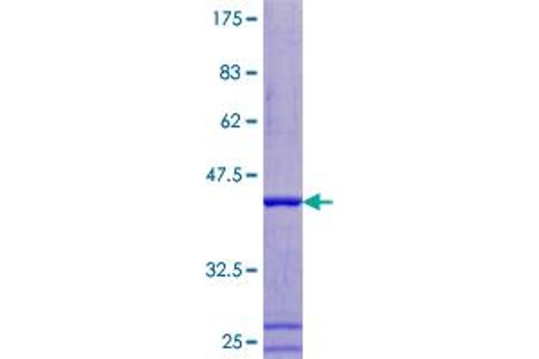 ATP6V1F Protein (AA 1-119) (GST tag)