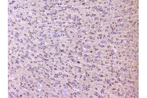 IHC analysis of RPS3 using anti-RPS3 antibody (ABIN6719371). (RPS3 antibody)