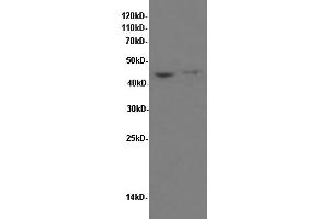 Western Blotting (WB) image for anti-TNF Receptor Superfamily, Member 6 (FAS) antibody (ABIN5959474) (FAS antibody)