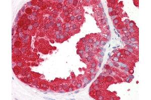 Anti-ACPP antibody IHC of human prostate. (ACPP antibody  (AA 269-282))