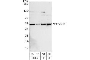 Western Blotting (WB) image for anti-Poly A Binding Protein Nuclear 1 (PABPN1) (AA 100-150) antibody (ABIN7454923)