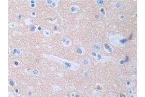 #VALUE! (Protein Phosphatase 3, Regulatory Subunit 1 (AA 2-170) antibody)