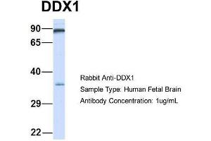 Host:  Rabbit  Target Name:  DDX1  Sample Type:  Human Fetal Brain  Antibody Dilution:  1. (DDX1 antibody  (Middle Region))