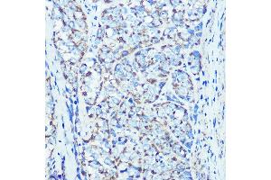 Immunohistochemistry of paraffin-embedded rat kidney using ATPB Rabbit mAb (ABIN7265722) at dilution of 1:100 (40x lens). (ATP5B antibody)