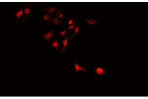 ABIN6268997 staining A549 cells by IF/ICC. (SIAH2 antibody  (C-Term))