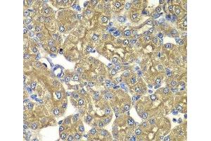 Immunohistochemistry of paraffin-embedded Rat kidney using PSMD5 Polyclonal Antibody at dilution of 1:100 (40x lens). (PSMD5 antibody)