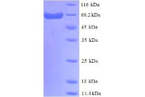 SDS-PAGE (SDS) image for delta Like Protein 3 (DLL3) (AA 27-492), (Extracellular) protein (His-SUMO Tag) (ABIN5711895) (DLL3 Protein (AA 27-492, Extracellular) (His-SUMO Tag))