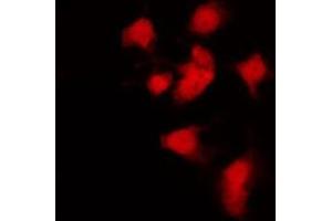 ABIN6269060 staining K562 by IF/ICC. (JAK2 antibody  (C-Term))