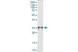 Immunoprecipitation of RAD54B transfected lysate using anti-RAD54B MaxPab rabbit polyclonal antibody and Protein A Magnetic Bead , and immunoblotted with RAD54B MaxPab mouse polyclonal antibody (B01) . (RAD54B antibody  (AA 1-158))