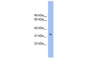 SLC25A1 antibody used at 1 ug/ml to detect target protein.