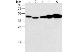 Western Blot analysis of Hela, Raji, Jurkat, A549 and NIH/3T3 cell using PPAT Polyclonal Antibody at dilution of 1:250 (PPAT antibody)
