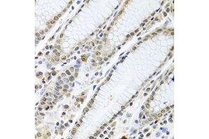Immunohistochemistry of paraffin-embedded human stomach using TIA1 antibody at dilution of 1:100 (40x lens). (TIA1 antibody)