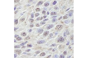 Immunohistochemistry (IHC) image for anti-Protein-Kinase, Interferon-Inducible Double Stranded RNA Dependent Inhibitor, Repressor of (p58 Repressor) (PRKRIR) (AA 150-200) antibody (ABIN7448742)