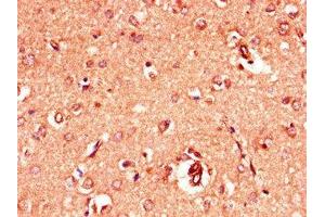 Immunohistochemistry of paraffin-embedded human brain tissue using ABIN7153965 at dilution of 1:100 (GRIA4 antibody  (AA 733-883))