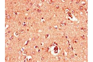 Immunohistochemistry of paraffin-embedded human brain tissue using ABIN7153965 at dilution of 1:100 (GRIA4 antibody  (AA 733-883))