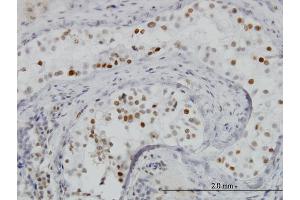 Immunostaining (ISt) image for anti-Bromodomain Containing 3 (BRD3) (AA 418-556) antibody (ABIN563515)