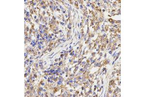 Immunohistochemistry (IHC) image for anti-Kinesin Light Chain 1 (KLC1) antibody (ABIN1876732) (KLC1 antibody)