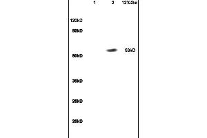 Lane 1: mouse embryo lysates Lane 2: human colon carcinoma lysates probed with Anti RBPJK/RBP-J Polyclonal Antibody, Unconjugated (ABIN872972) at 1:200 in 4C. (RBPJ antibody  (AA 101-200))