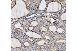 IHC analysis of Annexin VI/ANXA6 using anti-Annexin VI/ANXA6 antibody (ABIN5692982). (ANXA6 antibody  (AA 395-665))