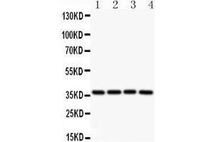 Observed bind size: 37KD