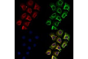 ABIN6258272 and ABIN6274405 staining Hela by IF/ICC. (MARK2 antibody  (Internal Region))