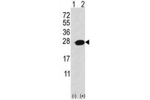 Image no. 1 for anti-Adenine Phosphoribosyltransferase (APRT) (C-Term) antibody (ABIN452752) (APRT antibody  (C-Term))