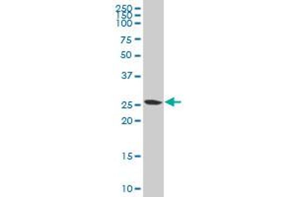 PMM2 antibody  (AA 47-111)