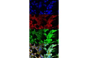 Immunocytochemistry/Immunofluorescence analysis using Mouse Anti-Methylglyoxal Monoclonal Antibody, Clone 9F11 . (Methylglyoxal (MG) antibody (HRP))