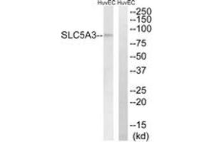 Western blot analysis of extracts from HuvEc cells, using SLC5A3 Antibody. (SLC5A3 antibody  (AA 221-270))
