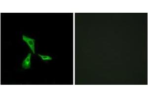 Immunofluorescence analysis of HeLa cells, using GPR101 Antibody.
