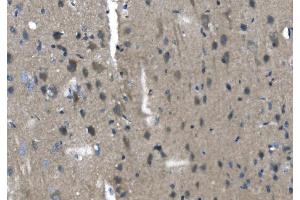 anti-Transmembrane Protease, Serine 3 (TMPRSS3) (AA 3-454) antibody