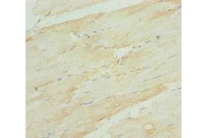 Immunohistochemistry of paraffin-embedded human skeletal muscle tissue using ABIN7168273 at dilution of 1:100 (A2BP1 antibody  (AA 1-130))