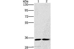 Western blot analysis of A172 and Raji cell, using FAIM2 Polyclonal Antibody at dilution of 1:500 (FAIM2 antibody)