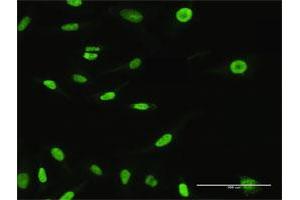 Immunofluorescence (IF) image for anti-Exportin 5 (XPO5) (AA 1-1204) antibody (ABIN528208)