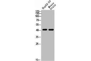 Western blot analysis of HEPG2-UV MOUSE-BRAIN using p-EDG-1 (T236) antibody. (S1PR1 antibody  (pThr236))