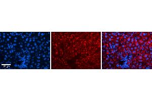 Rabbit Anti-IRF1 Antibody Catalog Number: ARP38129_P050 Formalin Fixed Paraffin Embedded Tissue: Human Liver Tissue Observed Staining: Cytoplasm in hepatocytes Primary Antibody Concentration: N/A Other Working Concentrations: 1:600 Secondary Antibody: Donkey anti-Rabbit-Cy3 Secondary Antibody Concentration: 1:200 Magnification: 20X Exposure Time: 0. (IRF1 antibody  (C-Term))