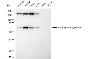 Western blotting analysis using Coenzyme A synthase antibody (ABIN7798104). (Recombinant COASY antibody)