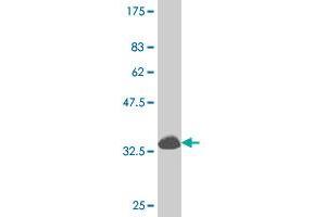 Western Blot detection against Immunogen (34. (DLX1 antibody  (AA 181-254))